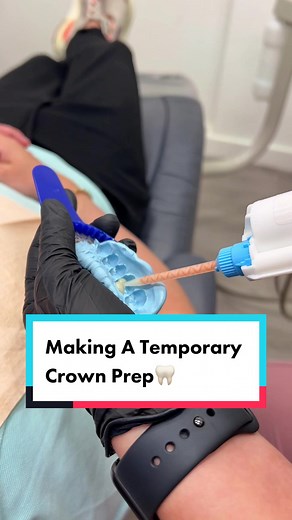 Making a Temporary Crown Prep