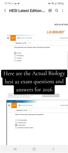 hesi exam help, Pay someone to pass your proctored hesi exam on proctoru #hesiexam #nursingschool #hesientranceexam #prenursing #hesia2exam
