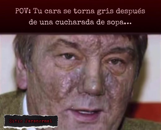 Fue a una cena como candidato presidencial… y salió convertido en el hombre más envenenado del mundo. El 5 de septiembre de 2004, el candidato ucraniano Viktor Yushchenko asistió a una cena privada en las afueras de Kiev, donde se reunió con el jefe de seguridad Ihor Smeshko en plena campaña electoral. Al día siguiente amaneció gravemente enfermo. En pocas semanas, su rostro cambió de forma impactante: inflamado, grisáceo y cubierto de cicatrices. Los médicos de la clínica Rudolfinerhaus confirm