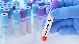 Are your hormones imbalanced? Doctors explain how to know if you need testing