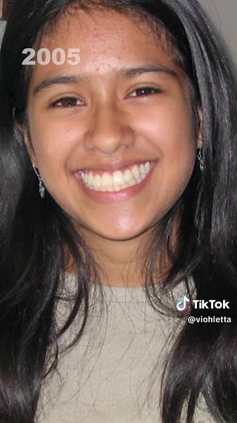 Hyper Skin Serum Review: Goodbye Backne Scars in 30 Days!