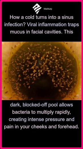 Why Sinus Infections Hurt | The Science of Sinus