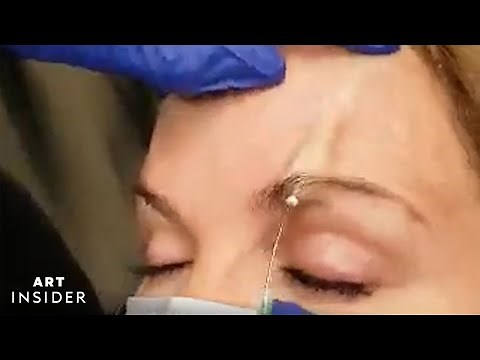 Nonsurgical Brow Lift Temporarily Raises Eyebrows