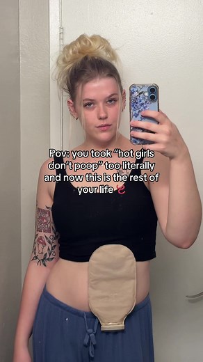 Life with an Ileostomy: Coping and Perspective