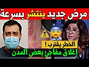 مرض جديد صامت يهدد العالم! تحذيرات خطيرة من خبراء الصحة