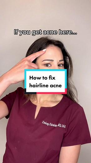 Effective Solutions for Hairline Acne Issues