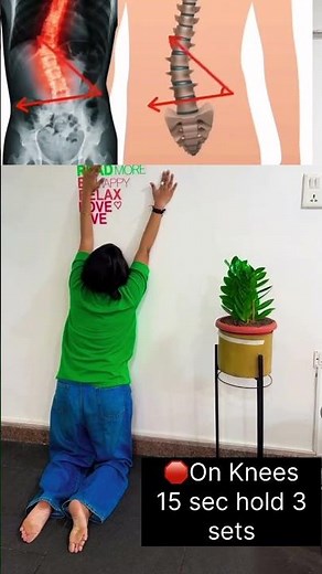 3 exercises for dextroscoliosis: Arogya physiotips #scoliosis #scoliosisawareness