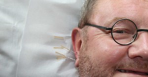 Tout savoir sur l'acupuncture : origines, principes et techniques