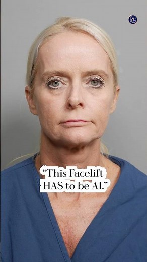 4 Months Post-Op #beverlyhillsplasticsurgery