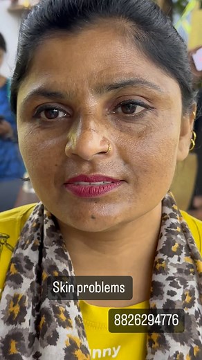 Skin problems 8826294776 | Nisha Lambha - Sparsh Beauty Care & Hair Treatment LLP