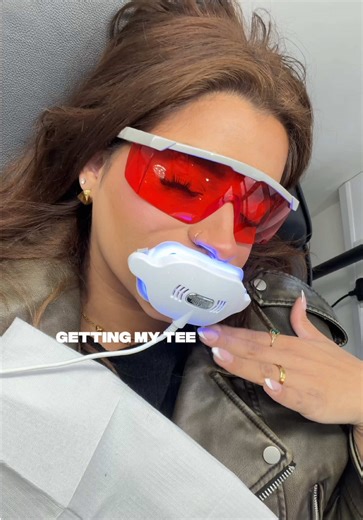 Getting my teeth whitened for the first time!! 🦷 @BIRMINGHAM TEETH WHITENING #teethwhitening #selfcare #birmingham #fyp