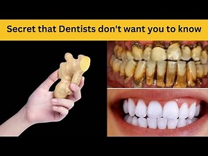 The 2-Minute Ginger Paste for Natural Teeth Whitening ✨