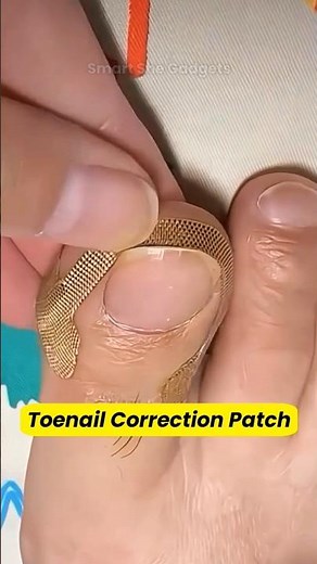 Toenail Correction Patch