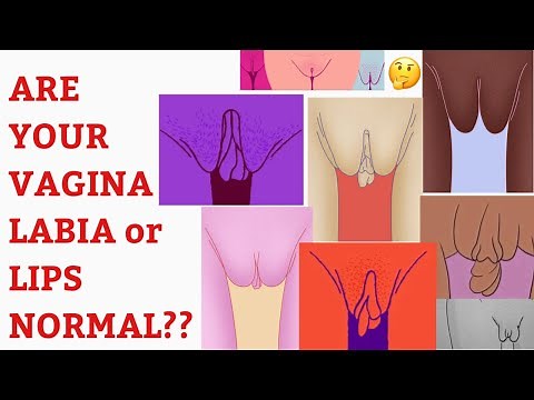 Are your Labias Normal? D&N Medical Series