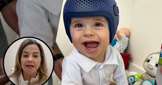 Assimetria craniana: como lidar com a cabeça 'achatada' do bebê