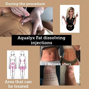 Aqualyx fat dissolving injections Get 3 areas done and the cheapest area is free Pm to book ❤️ | Fe Male Faces | Facebook