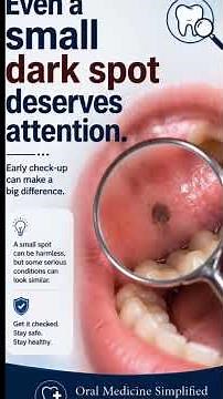Black Gums: Normal or Warning Sign?