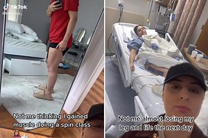 Woman reveals how she almost lost her leg after spin class