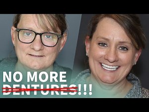 No More DENTURES with Innovative Dental IMPLANTS - Dr. O interviewed on the Wellness Hour