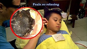 588K views · 2.3K reactions | Ear wax removal with Calm Music For...