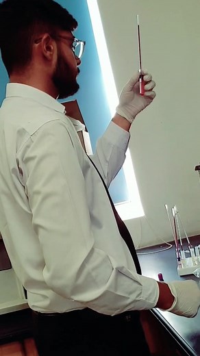 Erythrocyte Sedimentation Rate Procedure Explained