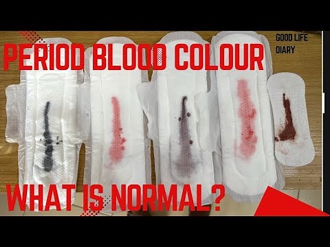 Period Blood Colors Explained: Myths & Health Facts Your Body Might Be Telling You