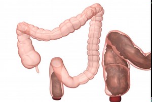 The Pooh in You auf Deutsch