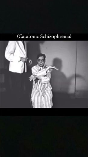 Catatonic Schizophrenia, Need more explanation??Do Comment ! | #trending #schizophrenia