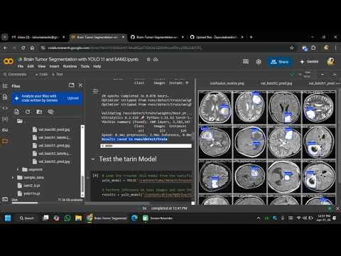 Brain Tumor Detection and Segmentation using YOLO and SAM