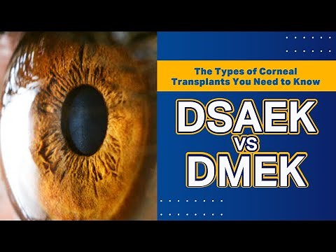 The Types of Corneal Transplants You Need to Know - DSAEK vs DMEK