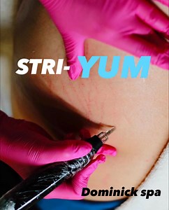 (no tengo derechos de música) ESTRÍAS??? Ya pasaron de moda...