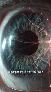 Diabetic Retinopathy vs. RP: How the Damage Differs! 👁️