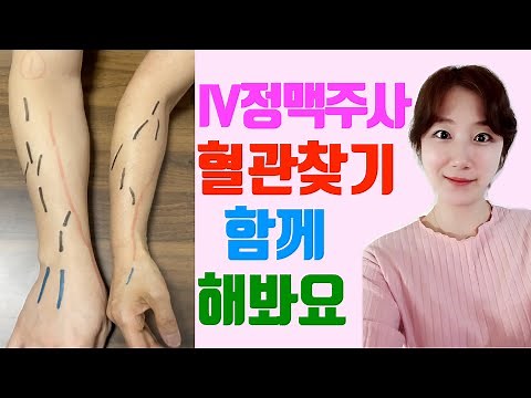 iv혈관찾는법 / 정맥주사놓을때 팔에서 혈관찾기 / iv혈관찾기 / 손등정맥 / iv주사혈관 / 팔혈관 / 정맥주사혈관위치