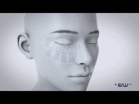 ESW vision Mechanism of Action