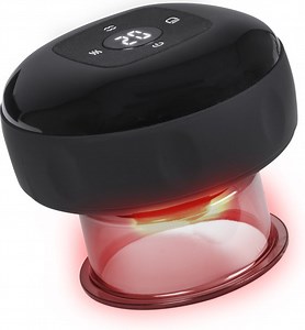 Nuvance Cupping Cup - Elektrisch - 12 Standen & Temperaturen - Cupping Set - Incl.... | bol