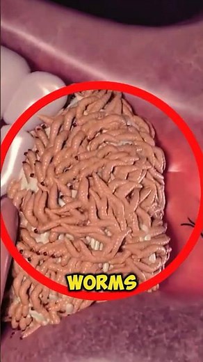 If You Ever Find Worms in Your Ear, Do This Instead