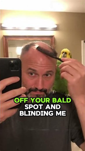 Parrot Tells Me the Truth About My Bald Spot #funny #relatable #parrot