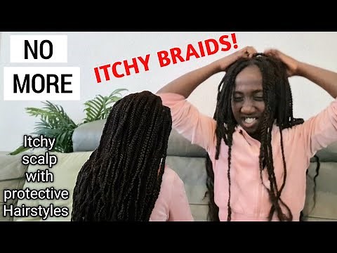 HOW TO COMPLETELY STOP THE ITCH IN YOUR BRAIDS AND PROTECTIVE STYLES|NATURAL 4C HAIR|CAUSES|SOLUTION