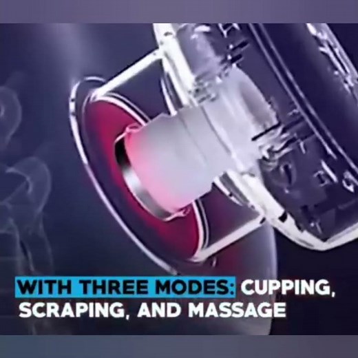 Electric Cupping Therapy Massager | Pain Relief, Muscle Recovery & Blood Circulation Booster