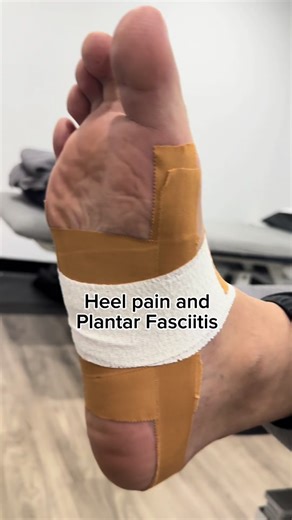 Low dye taping can be utilized to assist symptoms for a number of pathologies including Heel pain and Plantar Fasciitis. This method is often utilized to offload structures and assist with biomechanics during exercise #heelpain #plantarfasciitis #tape #physiotherapy