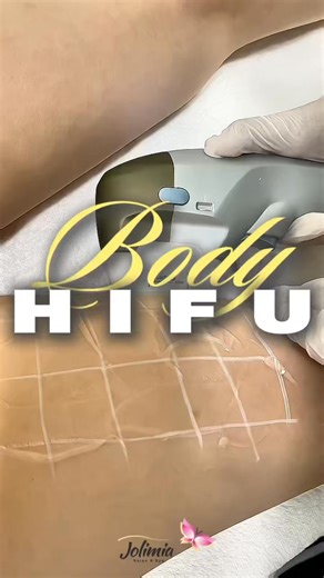 ✨ Body HIFU ✨ Redefine your body with advanced non-invasive technology 💫 Body HIFU helps tighten and firm the skin, improve elasticity, and reduce localized fat by stimulating natural collagen production. The result? A smoother, more sculpted, and toned appearance—without surgery or downtime ✨ Perfect for areas like abdomen, arms, thighs, and love handles 💖 Feel confident in your skin and love your body again 🌸 📍 Jolimia Salon & Spa 5144 Leesburg Pike, 2nd Floor Alexandria, VA 22302 📞 703-3