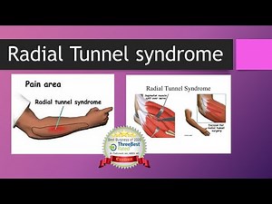 Radial Tunnel Syndrome