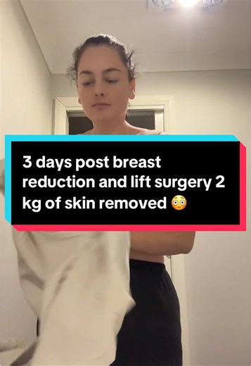 Breast Reduction and Lift Surgery: Before and After