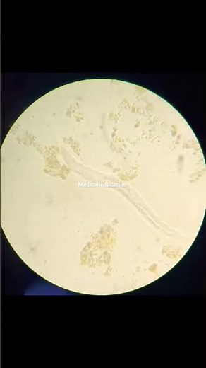 Human Parasites worm Under the Microscope
