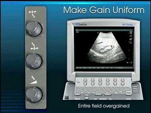 Clinical Ultrasound-Physics and Knobology.