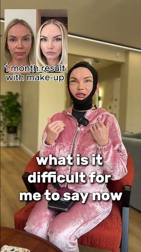 Amazing Face Lift Results | 5 days after surgery in Istanbul | Dr.CBS | #facelift #blepharoplasty