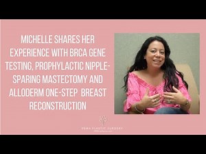 BRCA, Nipple-Sparing Mastectomy & One-Step Breast Reconstruction with Implants & Alloderm