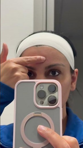 How to get rid of sebaceous hyperplasia bumps on face. #dermatologist