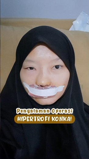 Pengalaman Operasi Konka Hidung - Hipertrofi Konka! #operasikonka #hipertrofikonka #latepost #fyp