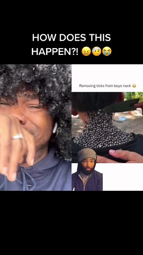 Ticks on Neck: Real or Fake? Full Video Revealed